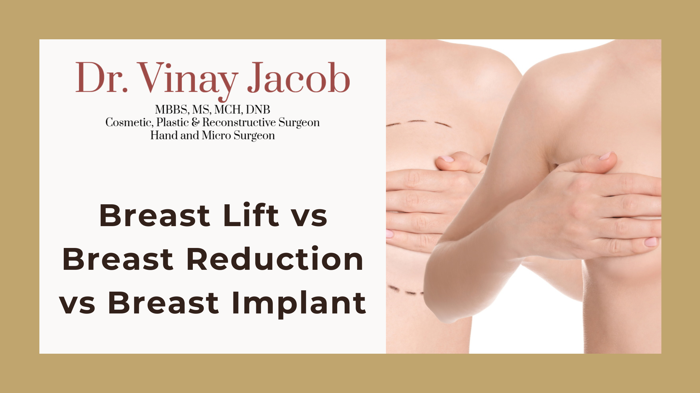 Breast Lift vs Breast Reduction vs Breast Implants: Which Procedure Is Right for You?